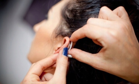 Otostick Normal korektory estetyczne uszu